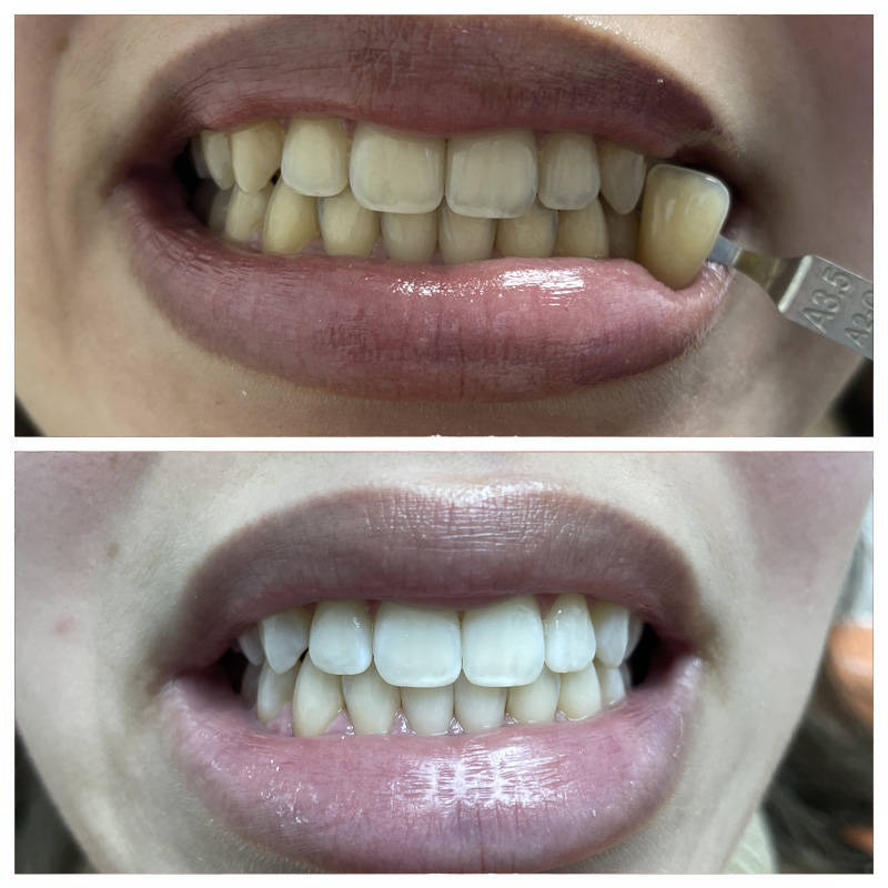 BaySmiles Dental | Oral Exams, Dental Bridges and Implant Dentistry