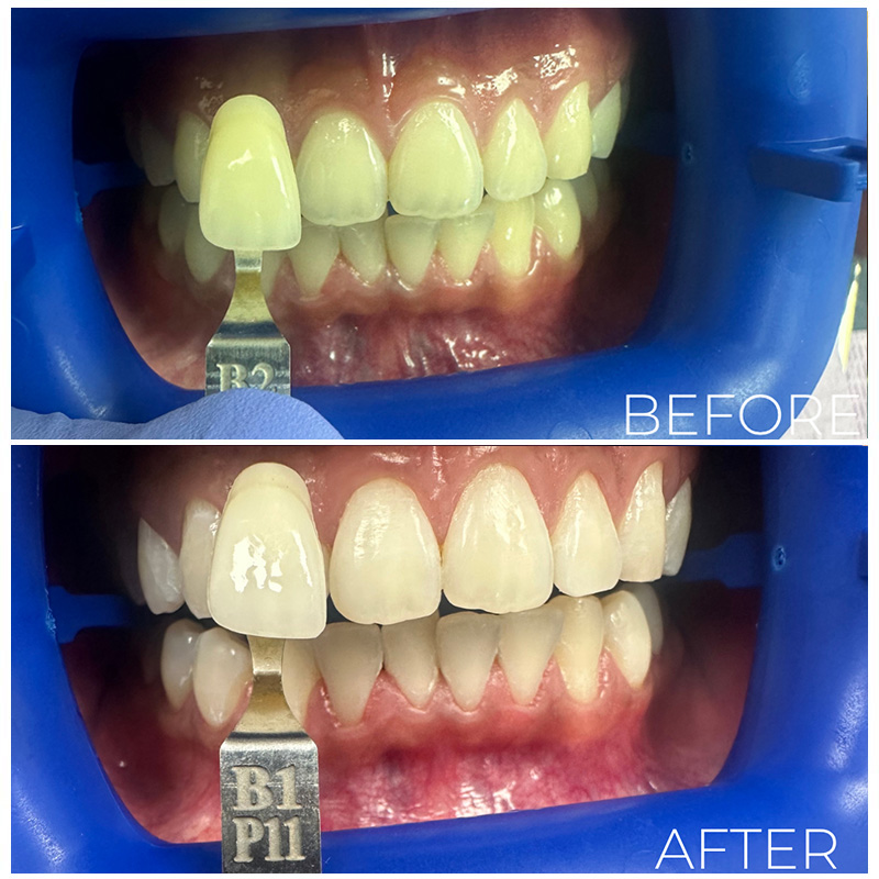 BaySmiles Dental | Oral Exams, Dental Fillings and Dentures