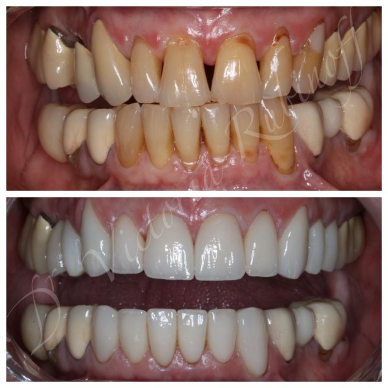 BaySmiles Dental | Oral Exams, Cosmetic Dentistry and Dental Bridges