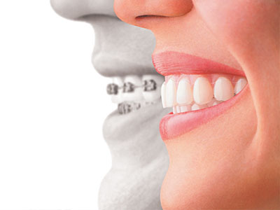 The image features a composite of two individuals, one on the left side showing a smiling face and the other on the right with an open mouth displaying dental implants.