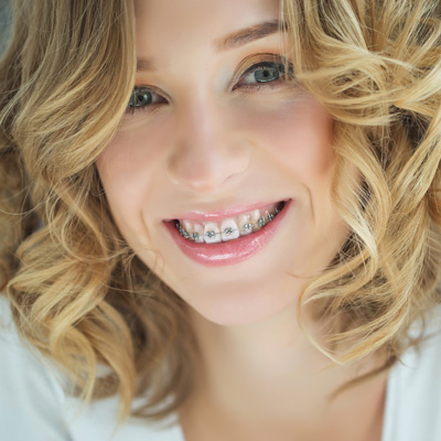 A woman with a bright smile, wearing braces, against a white background.